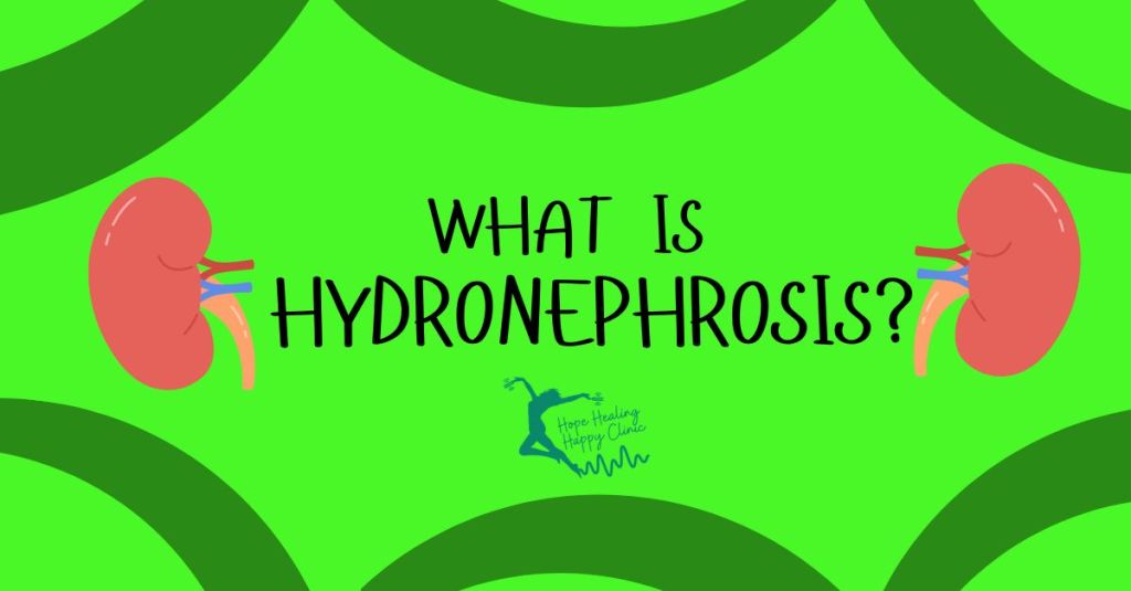 What is Hydronephrosis?